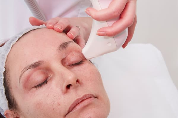 Skin Tighten